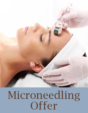 Microneedling Offer Microneedling Offer