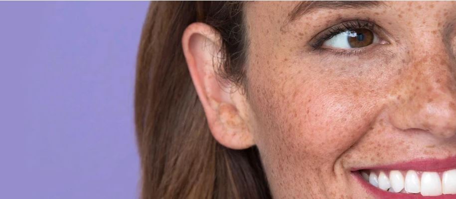 Radiant Skin Canterbury Beauty Salon